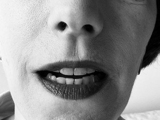 Catharina Arp – Weicher Gaumen & Nasalität: Immer wieder spannend!